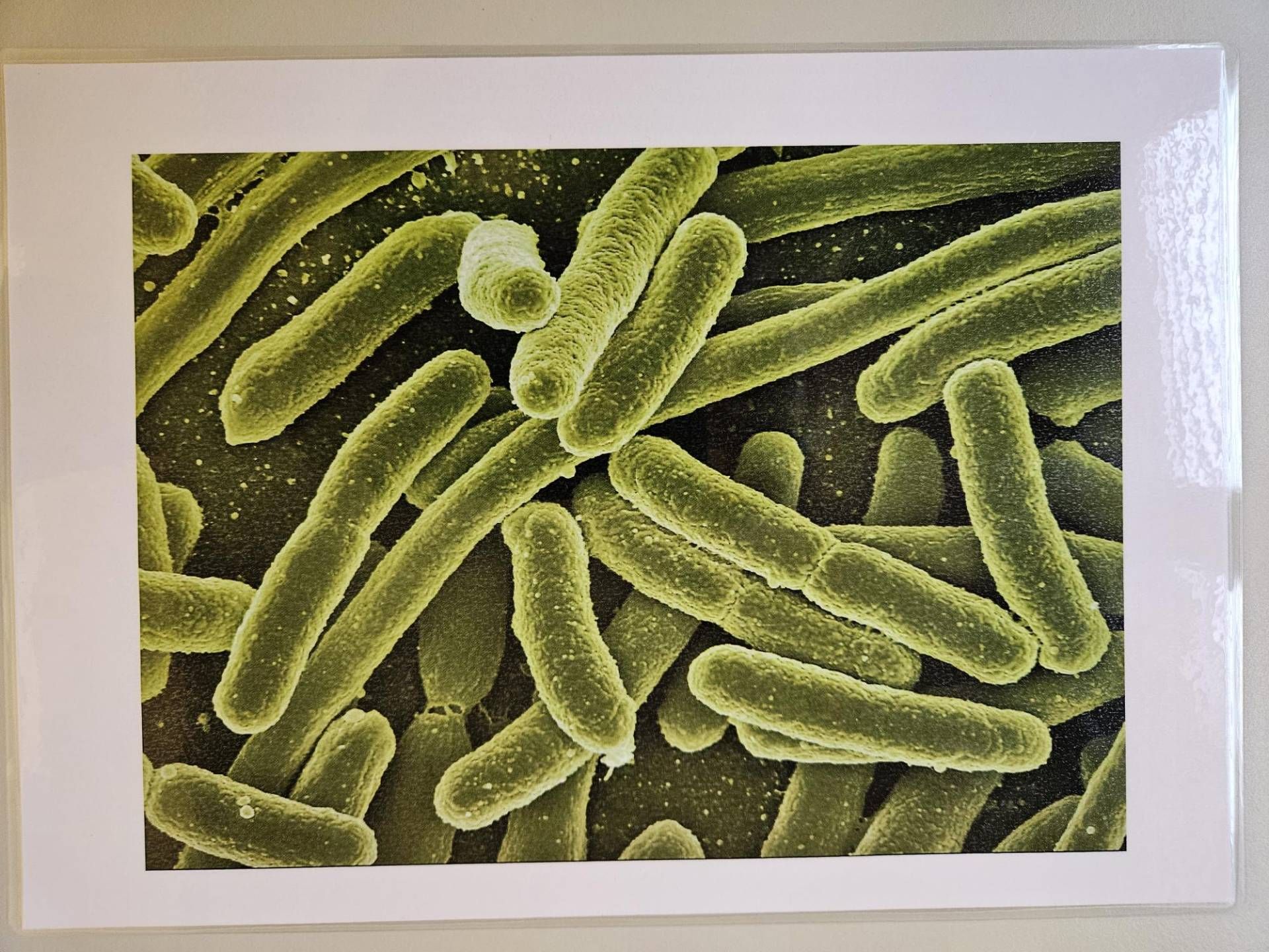 Bakterien, die Karies verursachen