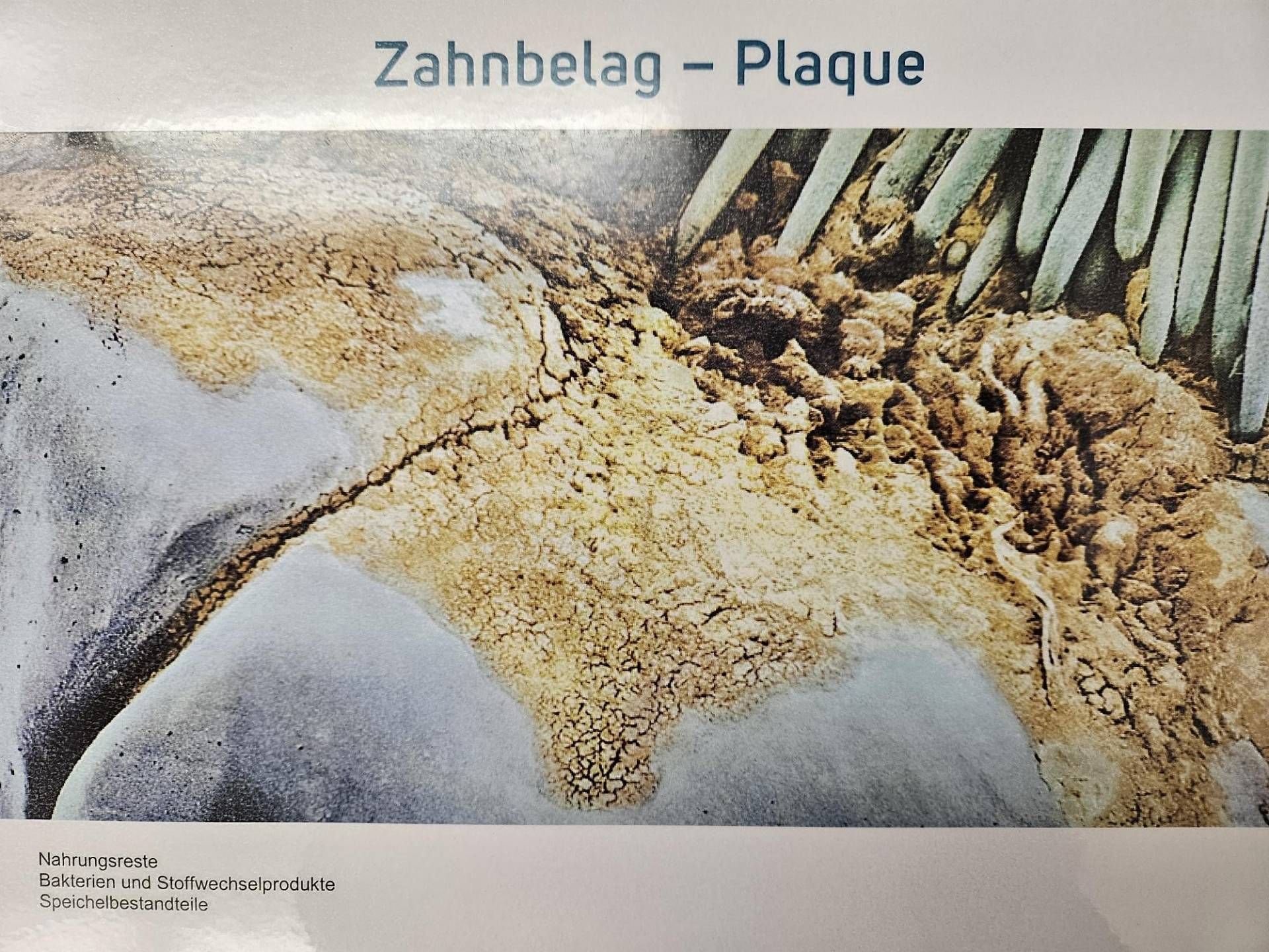 Zahnbelag unter dem Mikroskop